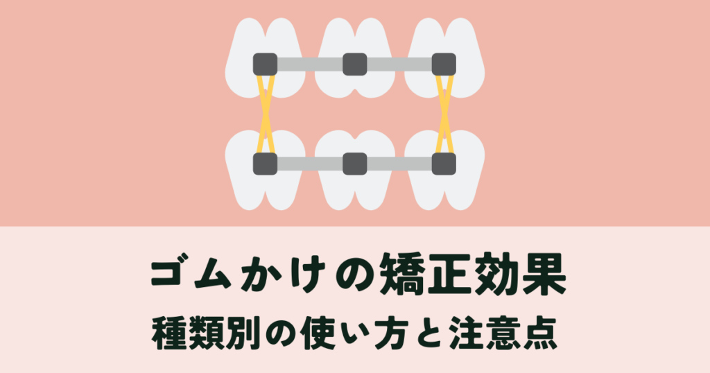 歯科矯正！ゴムかけで効果UP！種類別の使い方と注意点