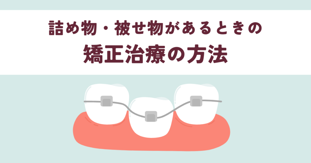 詰め物・被せ物があっても大丈夫？矯正治療の方法