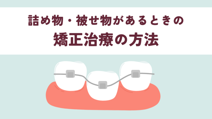 詰め物・被せ物があっても大丈夫？矯正治療の方法