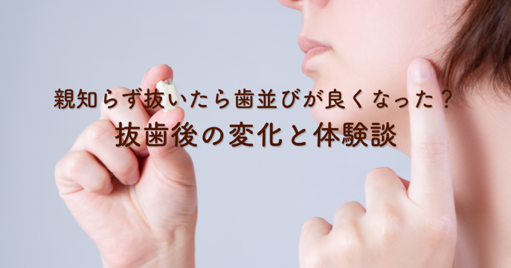 親知らず抜いたら歯並びが良くなった？抜歯後の変化と体験談