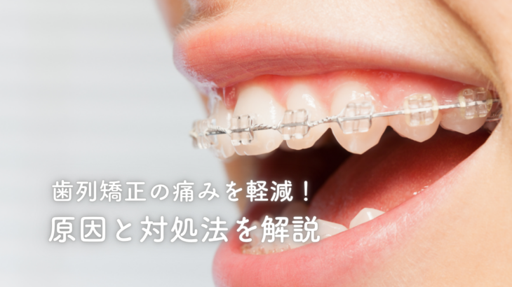 歯列矯正の痛みを軽減！原因と対処法を解説