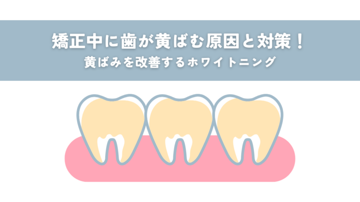 矯正中に歯が黄ばむ原因と対策！黄ばみを改善するホワイトニング
