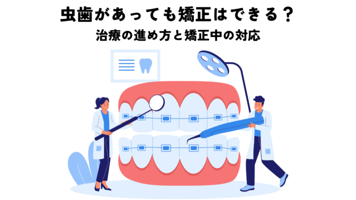 虫歯があっても矯正はできる？治療の進め方と矯正中の対応