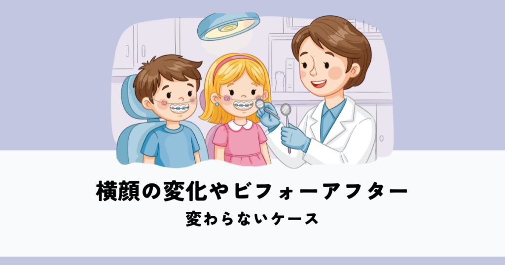 矯正による横顔の変化やビフォーアフターとは？変わらないケースも解説
