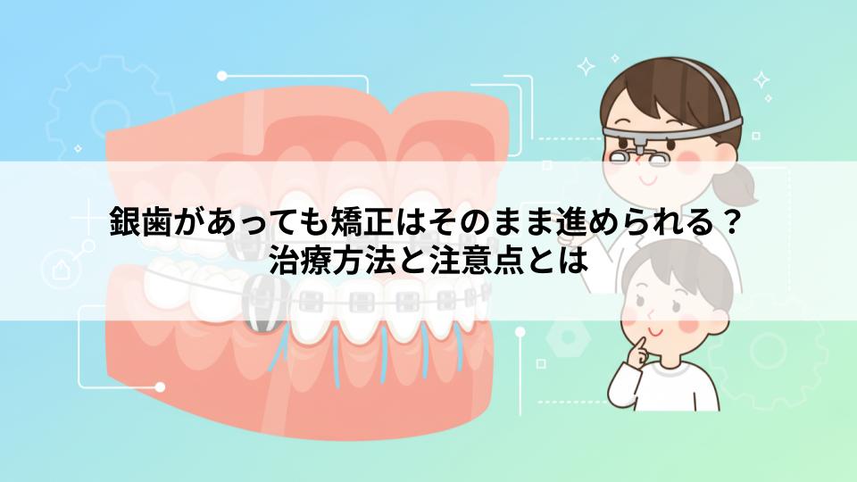 銀歯があっても矯正はそのまま進められる？治療方法と注意点とは